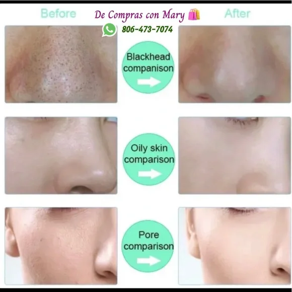 Silicone electric facial brush. Perfect for clogged pores, acne, excess oil, - Picture 8 of 9